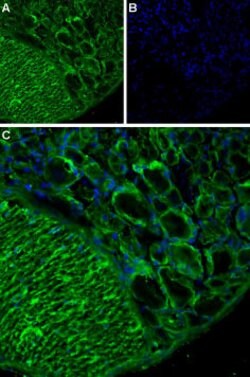 TRPA1 (extracellular) Polyclonal Antibody, Invitrogen 50 &mu;L; Unconjugated:Antibodies,
