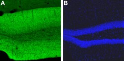 CaV1.2 Polyclonal Antibody, Invitrogen 50 &mu;L; Unconjugated:Antibodies,