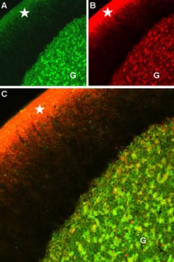 CaV1.2 Polyclonal Antibody, Invitrogen 50 &mu;L; Unconjugated:Antibodies,