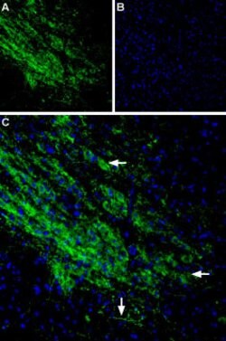 Kir3.2 (KCNJ6) Polyclonal Antibody, Invitrogen 50 &mu;L; Unconjugated:Antibodies,