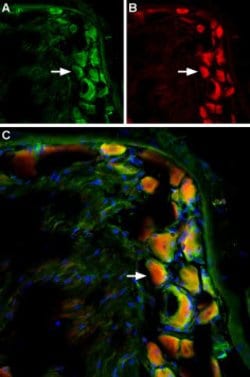TRPV2 (extracellular) Polyclonal Antibody, Invitrogen 50 &mu;L; Unconjugated:Antibodies,