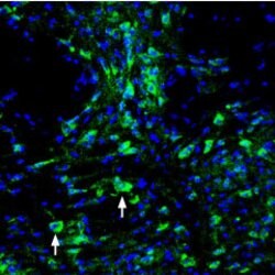 ASIC3 Polyclonal Antibody, Invitrogen 50 &mu;L; Unconjugated:Antibodies,