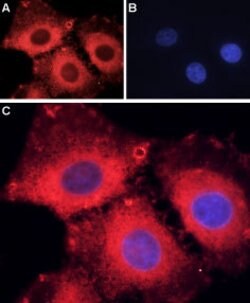 ASIC1 Polyclonal Antibody, Invitrogen 50 &mu;L; Unconjugated:Antibodies,
