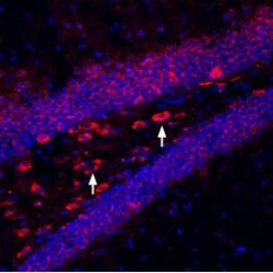 Kir6.2 (KCNJ11) Polyclonal Antibody, Invitrogen 50 &mu;L; Unconjugated:Antibodies,