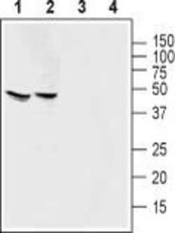 MAS1 Polyclonal Antibody, Invitrogen 50 &mu;L; Unconjugated:Antibodies,