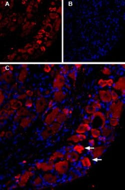 TRPV1 Polyclonal Antibody, Invitrogen 50 &mu;L; Unconjugated:Antibodies,