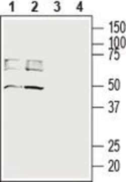 SLC16A3 Polyclonal Antibody, Invitrogen 50 &mu;L; Unconjugated:Antibodies,