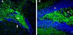 Synapsin II Polyclonal Antibody, Invitrogen 50 &mu;L; Unconjugated:Antibodies,