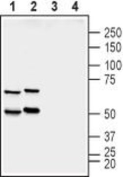 Synapsin II Polyclonal Antibody, Invitrogen 50 &mu;L; Unconjugated:Antibodies,