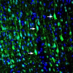 LRRTM1 (extracellular) Polyclonal Antibody, Invitrogen 50 &mu;L; Unconjugated:Antibodies,