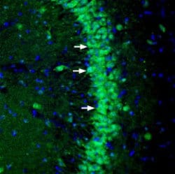 LRRC4B (extracellular) Polyclonal Antibody, Invitrogen 50 &mu;L; Unconjugated:Antibodies,