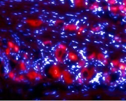 RET (extracellular) Polyclonal Antibody, Invitrogen 50 &mu;L; Unconjugated:Antibodies,