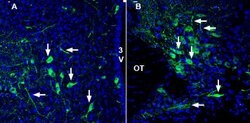 SLC17A9 Polyclonal Antibody, Invitrogen 50 μL; Unconjugated:Antibodies,