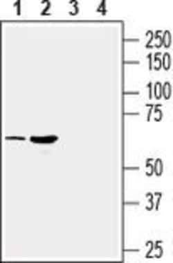 SLC17A9 Polyclonal Antibody, Invitrogen 50 μL; Unconjugated:Antibodies,