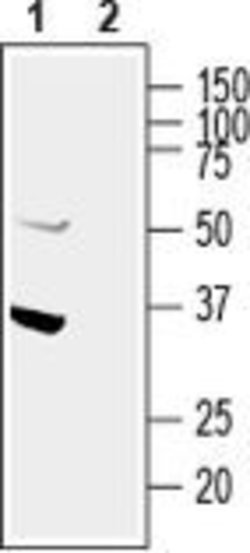 GIPC1 Polyclonal Antibody, Invitrogen 50 &mu;L; Unconjugated:Antibodies,