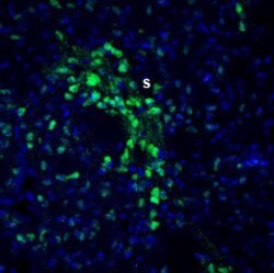 SLITRK2 (extracellular) Polyclonal Antibody, Invitrogen 50 &mu;L; Unconjugated:Antibodies,