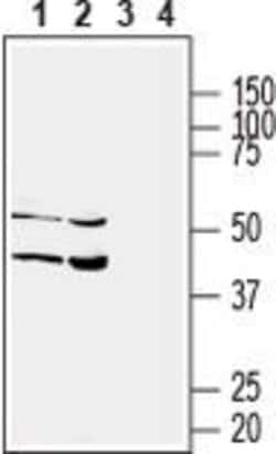 SLC17A5 Polyclonal Antibody, Invitrogen 50 &mu;L; Unconjugated:Antibodies,