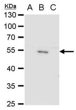 Invitrogen Japanese Encephalitis Envelope Protein Polyclonal Antibody 100