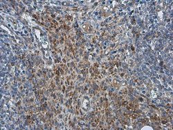 Invitrogen PRRS Virus M Protein Polyclonal Antibody 100 μL; Unconjugated:Antibodies,