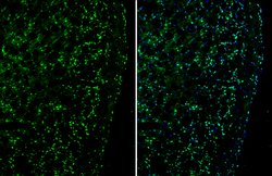 Invitrogen PLXND1 Polyclonal Antibody 100 μL; Unconjugated:Antibodies,