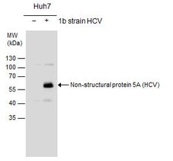 Invitrogen Hepatitis C Virus NS5A Polyclonal Antibody 100 &mu;L; Unconjugated:Antibodies,
