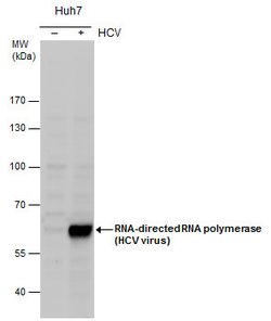 Invitrogen Hepatitis C Virus NS5b Polyclonal Antibody 100 &mu;L; Unconjugated:Antibodies,
