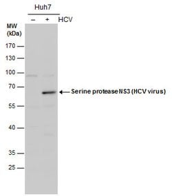 Invitrogen Hepatitis C Virus NS3 Polyclonal Antibody 100 &mu;L; Unconjugated:Anticuerpos