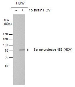 Invitrogen Hepatitis C Virus NS3 Polyclonal Antibody 100 &mu;L; Unconjugated:Anticuerpos