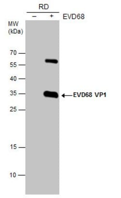 Invitrogen Enterovirus D68 VP1 Polyclonal Antibody 100 μL; Unconjugated:Antibodies,