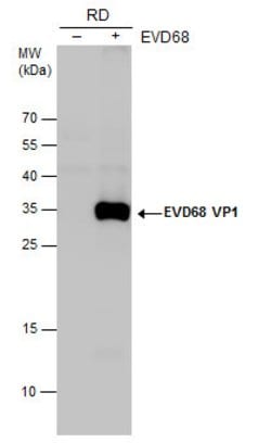 Invitrogen Enterovirus D68 VP1 Polyclonal Antibody 100 &mu;L; Unconjugated:Antibodies,