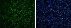 Invitrogen Enterovirus 71 VP1 Polyclonal Antibody 100 &mu;L; Unconjugated:Antibodies,
