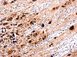 Invitrogen Enterovirus 71 VP1 Polyclonal Antibody 100 &mu;L; Unconjugated:Antibodies,