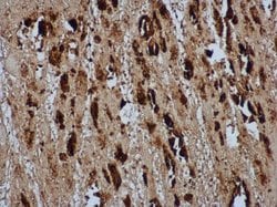 Invitrogen Enterovirus 71 VP2 Polyclonal Antibody 100 &mu;L; Unconjugated:Antibodies,