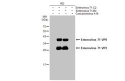 Invitrogen Enterovirus 71 VP2 Polyclonal Antibody 100 &mu;L; Unconjugated:Antibodies,