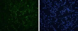 Invitrogen Enterovirus 71 VP3 Polyclonal Antibody 100 μL; Unconjugated:Antibodies,