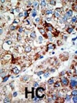 Invitrogen USP21 Polyclonal Antibody 400 μL; Unconjugated:Antibodies,