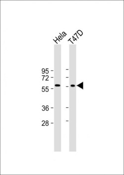Invitrogen USP21 Polyclonal Antibody 400 μL; Unconjugated:Antibodies,