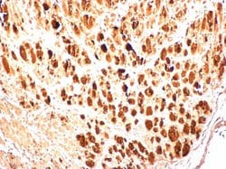 Invitrogen Enterovirus 71 3AB Polyclonal Antibody 100 &mu;L | Buy Online | Invitrogen&trade; | Fisher Scientific