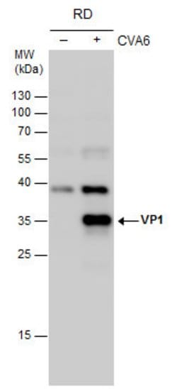 Invitrogen Coxsackievirus A6 VP1 Polyclonal Antibody 100 &mu;L; Unconjugated:Antibodies,