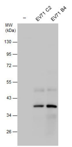Invitrogen Enterovirus 71 2C Polyclonal Antibody 100 &mu;L; Unconjugated:Antibodies,