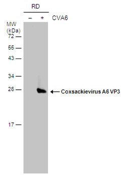 Invitrogen Coxsackievirus A6 VP3 Polyclonal Antibody 100 &mu;L; Unconjugated:Antibodies,
