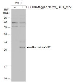 Invitrogen Norovirus VP2 Polyclonal Antibody 100 &mu;L | Buy Online | Invitrogen&trade; | Fisher Scientific