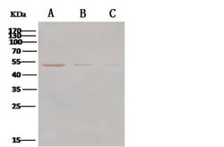 Invitrogen MERS Coronavirus NP Polyclonal Antibody 100 μL; Unconjugated:Antibodies,