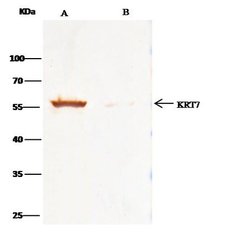 Invitrogen Cytokeratin 7 Polyclonal Antibody 100 μL; Unconjugated:Antibodies,