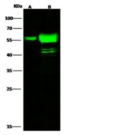 Invitrogen Cytokeratin 7 Polyclonal Antibody 100 μL; Unconjugated:Antibodies,
