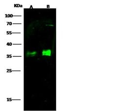 Invitrogen MBL2 Polyclonal Antibody 100 &mu;L; Unconjugated:Antibodies,