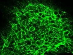 Invitrogen CCR1 Polyclonal Antibody 100 &mu;L; Unconjugated:Antibodies,