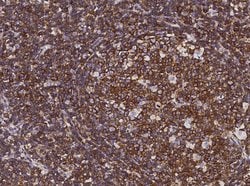 Invitrogen CCR1 Polyclonal Antibody 100 &mu;L; Unconjugated:Antibodies,
