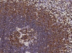Invitrogen CCR1 Polyclonal Antibody 100 &mu;L; Unconjugated:Antibodies,