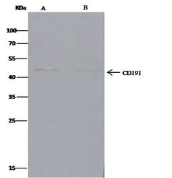 Invitrogen CCR1 Polyclonal Antibody 100 &mu;L; Unconjugated:Antibodies,